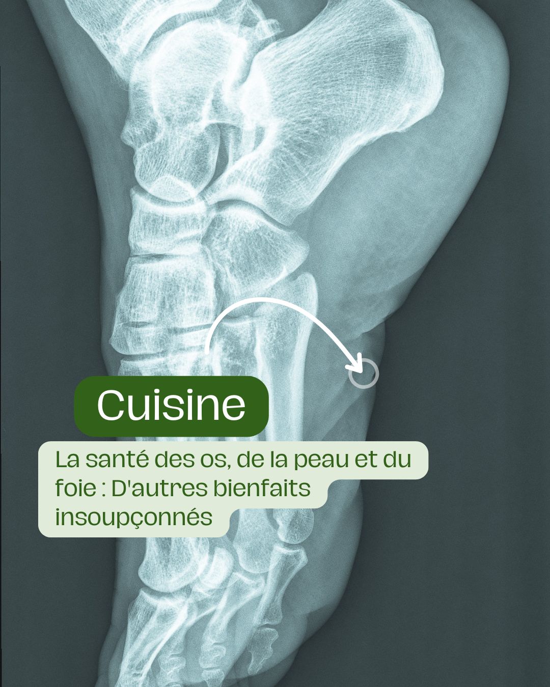 La santé des os, de la peau et du foie D'autres bienfaits insoupçonnés